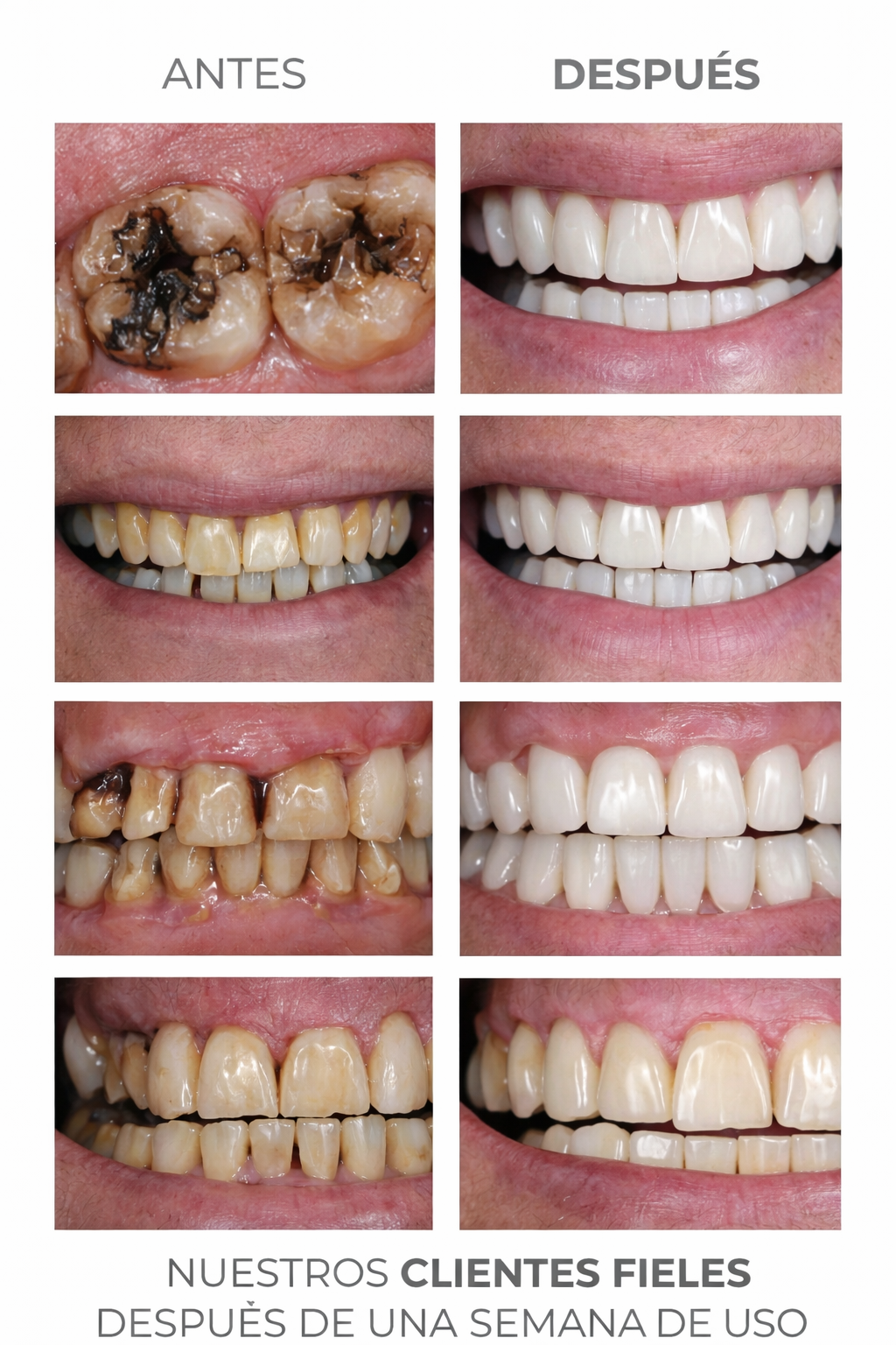 Hydroxyapatite Repair Pro™