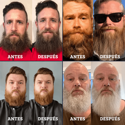 CEPILLO IONICO BARBEX™ - Peina tu barba y cabello en segundos 🧔🏻‍♂️