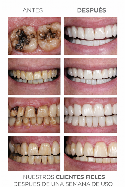 Hydroxyapatite Repair Pro™